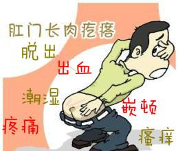 肛門乳頭癥狀,合肥肛腸醫院,合肥中山醫院